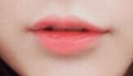 더웨이성형외과 이미지