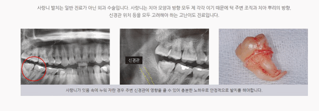 연세고운미소치과의원 이미지
