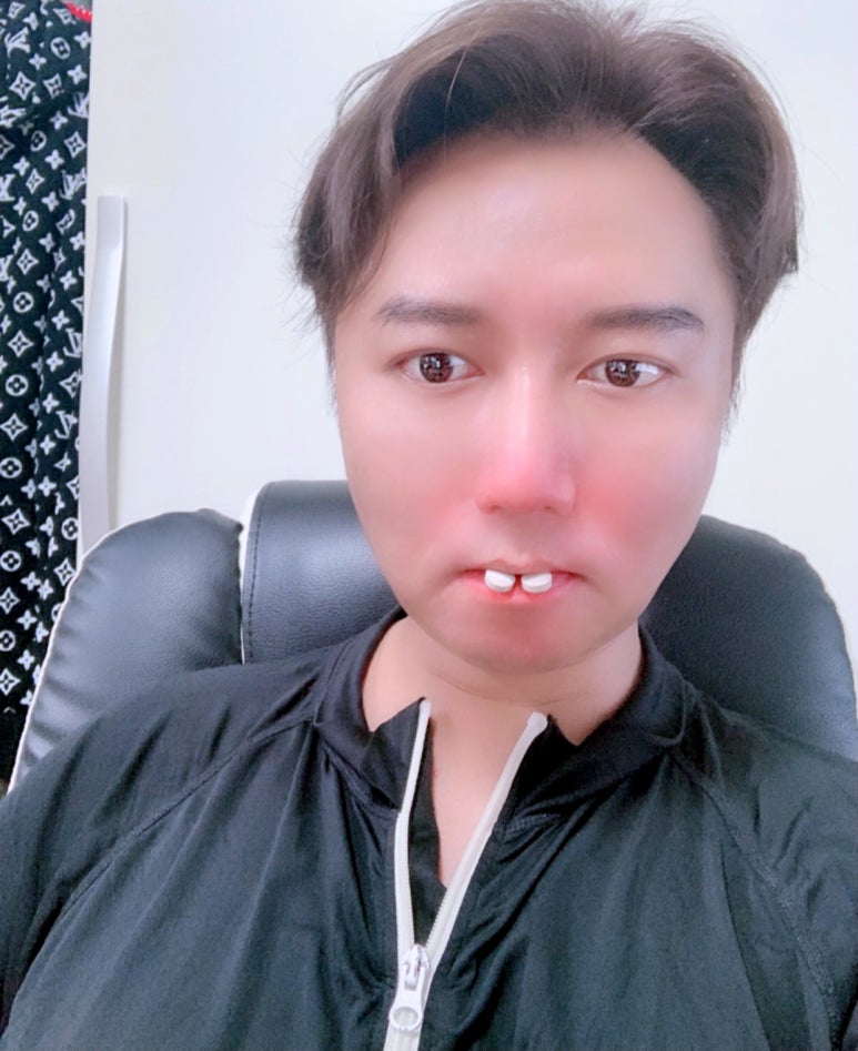 엘2알 이미지