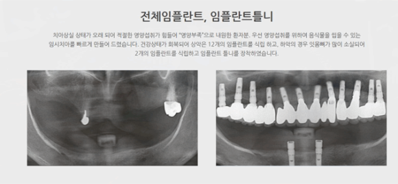 연세고운미소치과의원 이미지