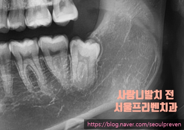 서울프리벤치과의원 이미지