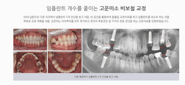 연세고운미소치과의원 이미지