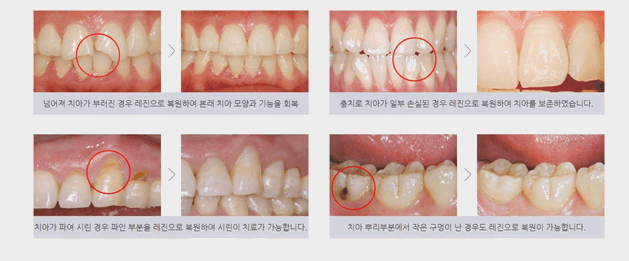 연세고운미소치과의원 이미지