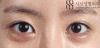 (7328)%EC%A0%84%ED%9B%84-%EC%A0%95%EB%A9%B4.gif?type=w773