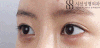 (7328)%EC%A0%84%ED%9B%84-45%EB%8F%84.gif?type=w773