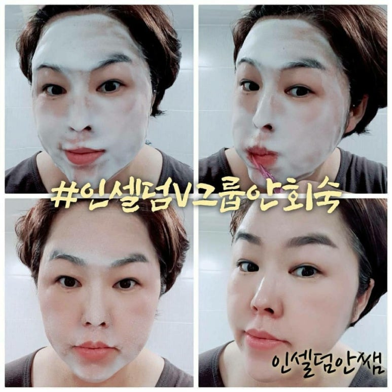 초이스 인셀덤 이미지