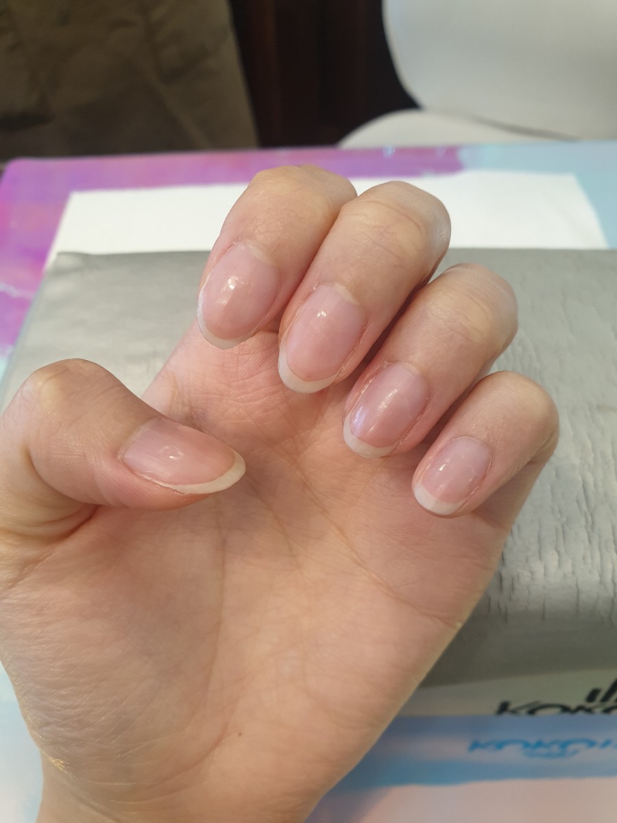 마이토비네일 이미지