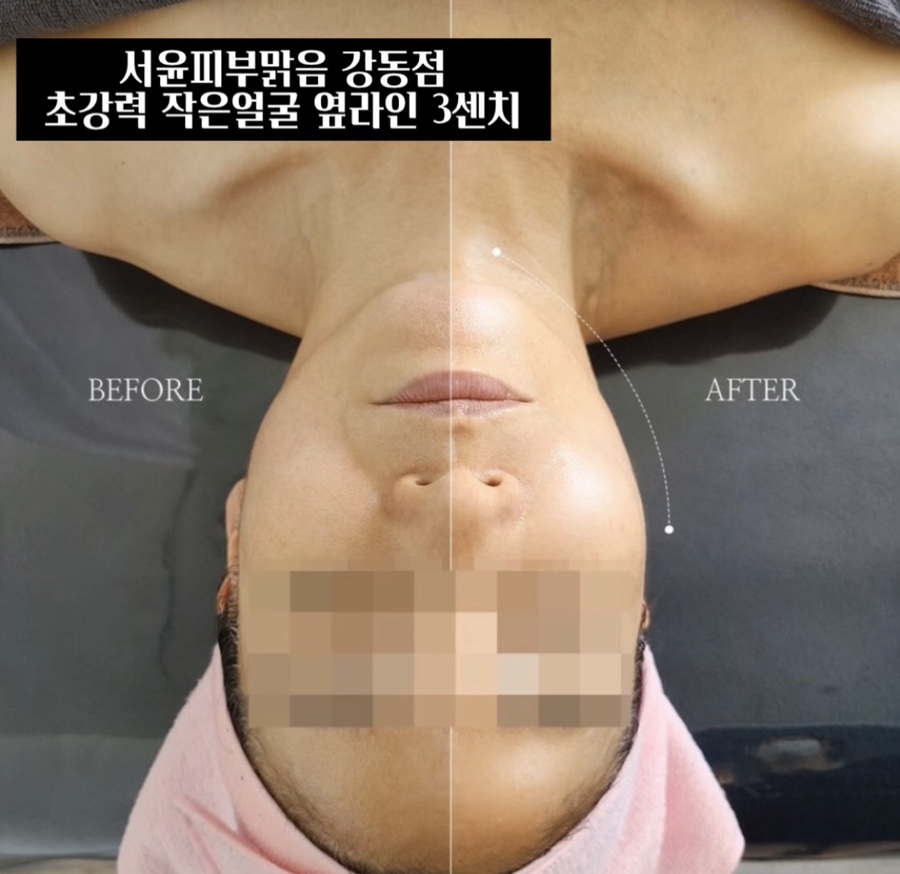 피부,맑음 이미지