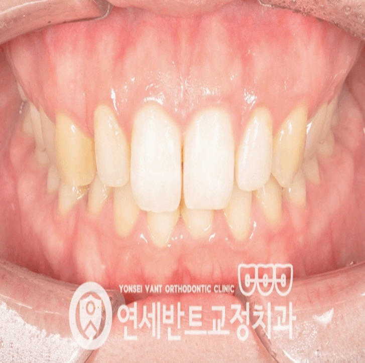 연세길치과의원 이미지