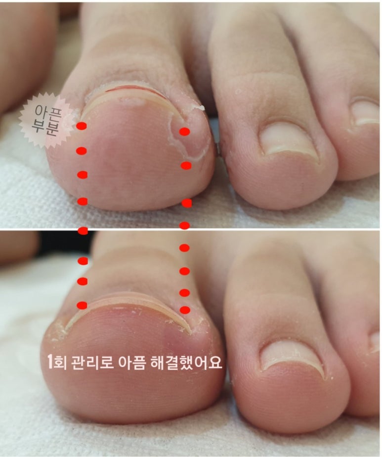 로제네일 이미지
