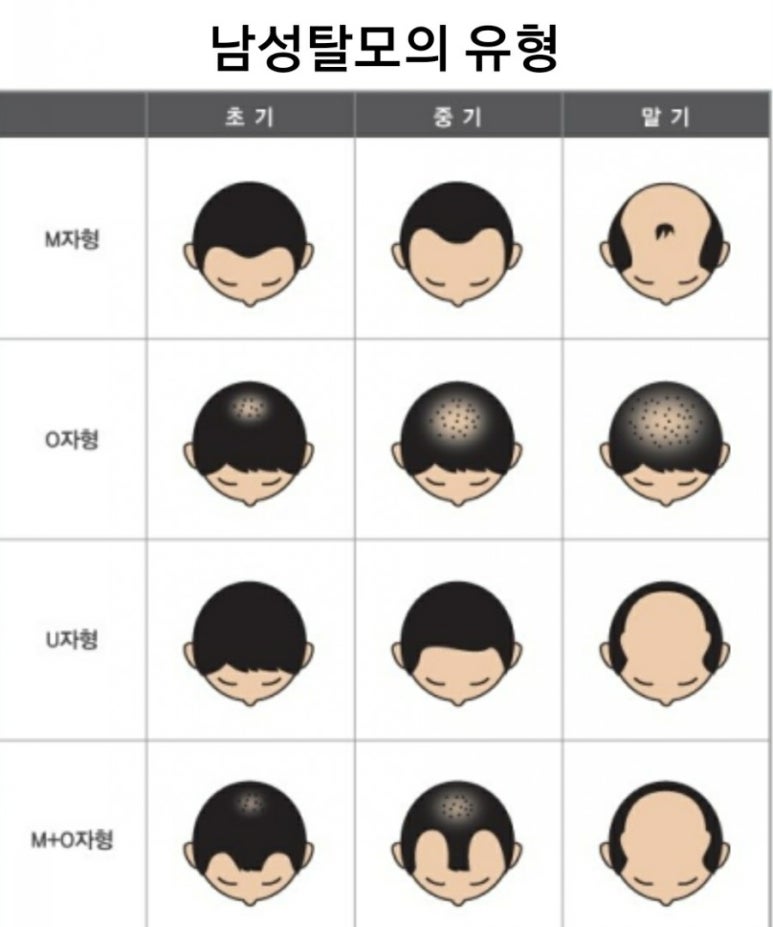 정화머리방 이미지