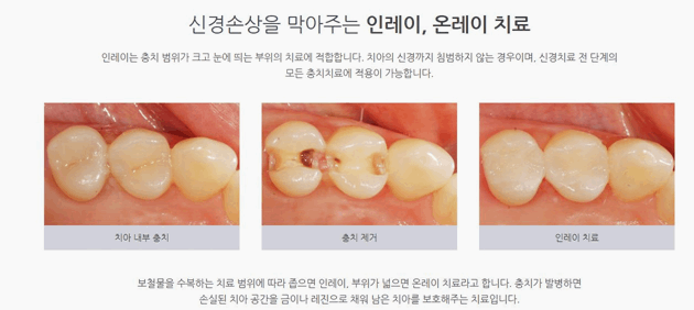 서울미소치과의원 이미지