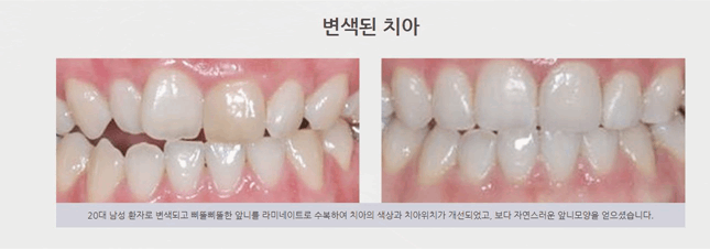 연세고운미소치과의원 이미지