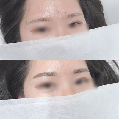 눈썹이날개다 이미지