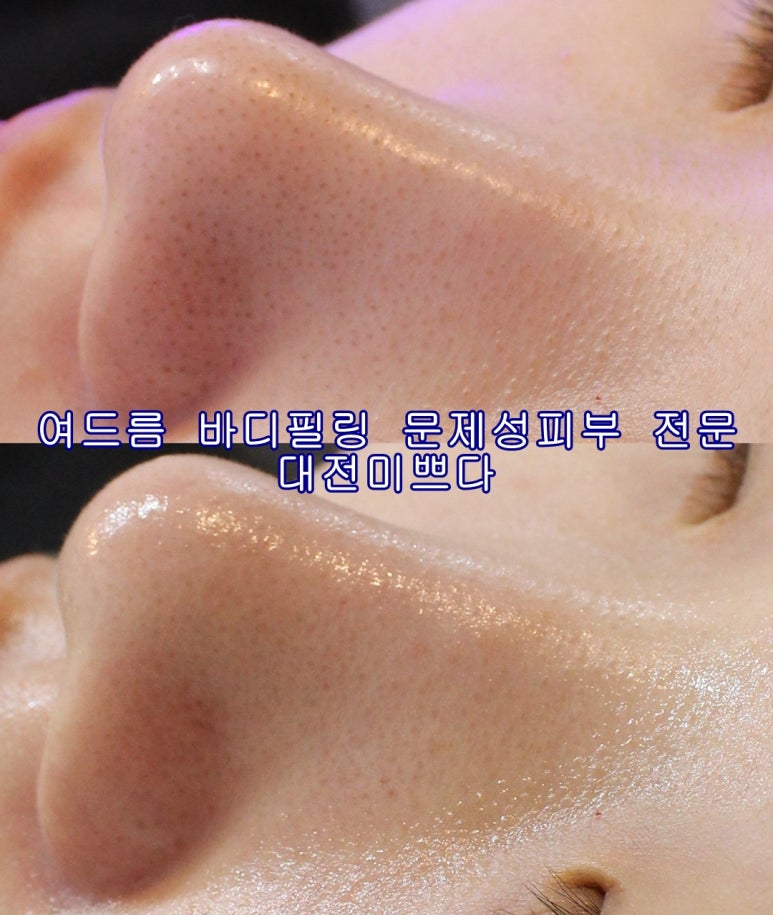 미쁘다피부관리 이미지