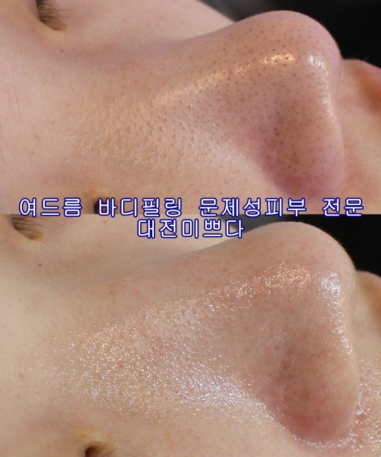 미쁘다피부관리 이미지