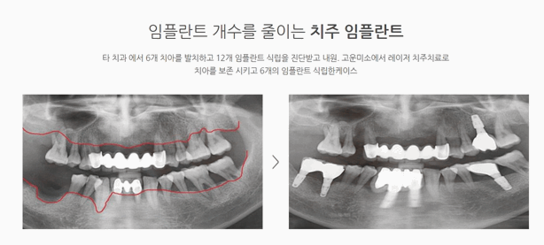 연세본치과의원 이미지