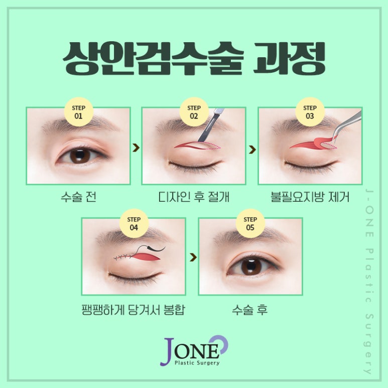 제이원병원 이미지