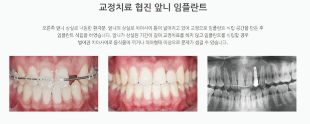 연세고운미소치과의원 이미지