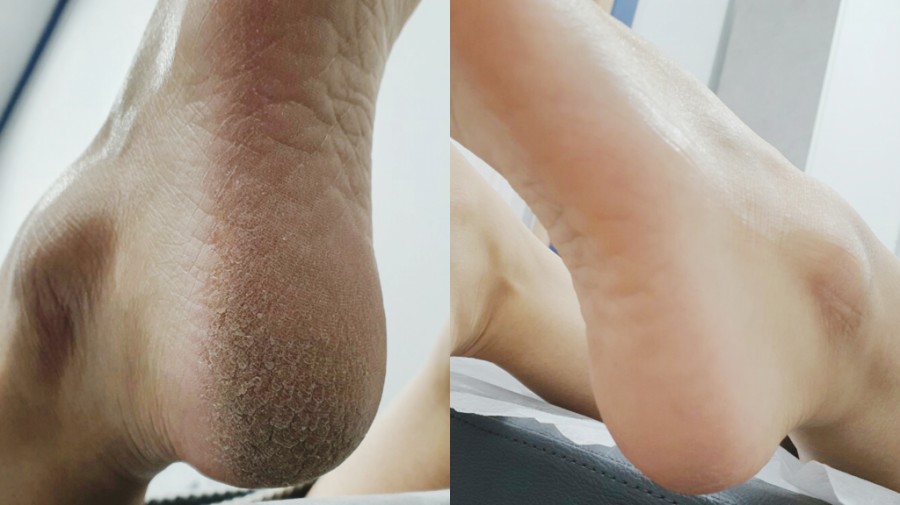 끌림 스킨케어 이미지