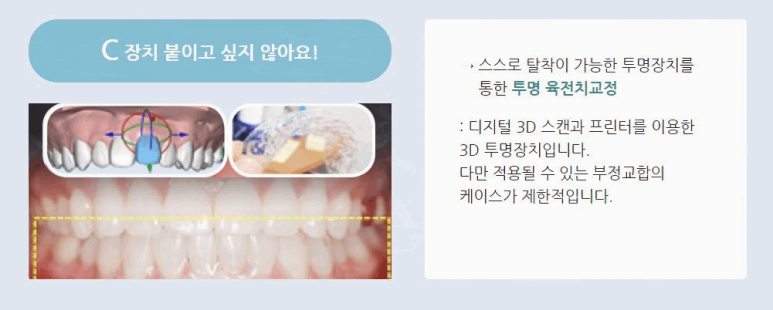 연세고운미소치과의원 이미지