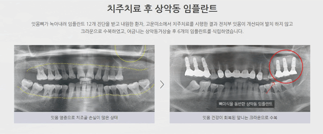 연세고운미소치과의원 이미지