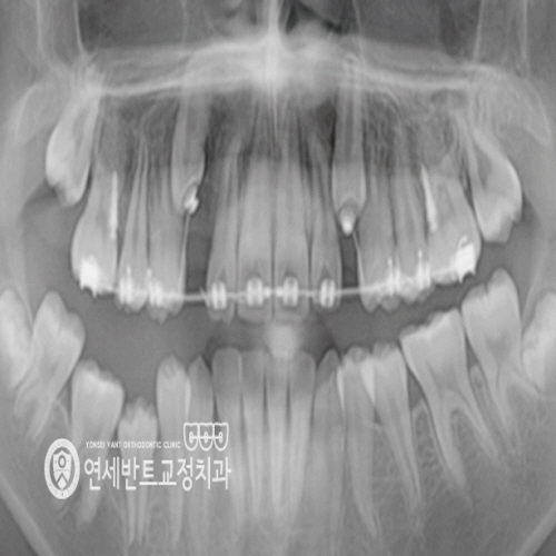 연세믿음치과 이미지