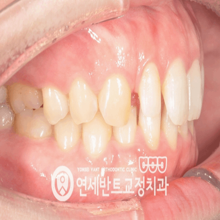반트치과교정과치과의원 이미지