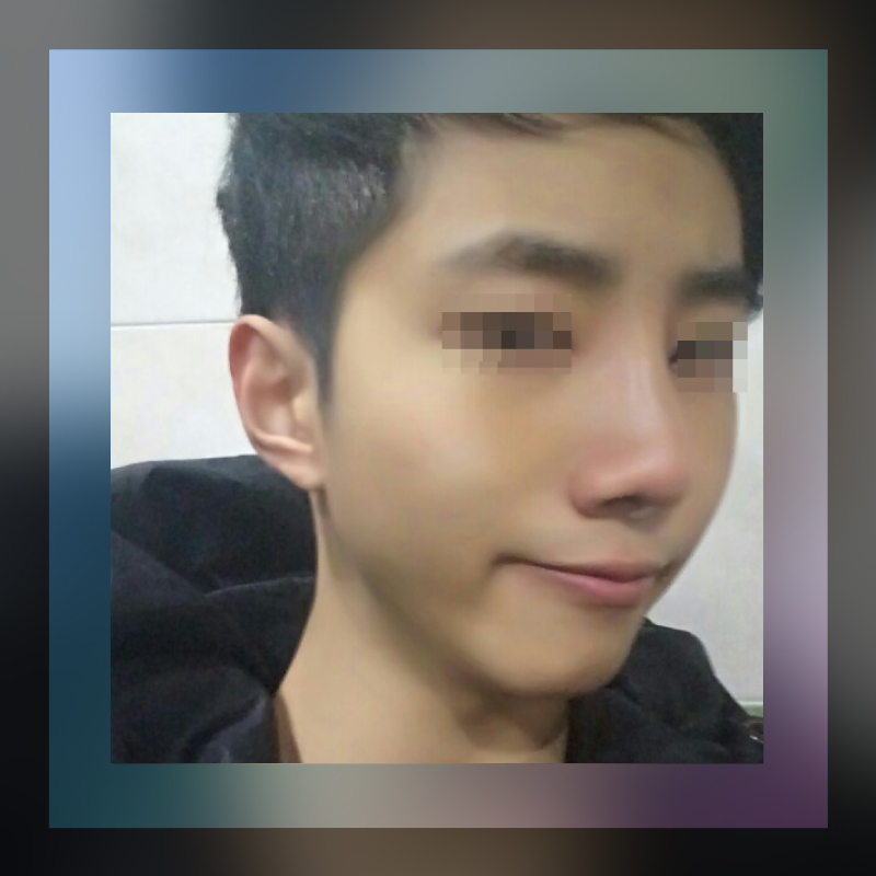 리얼성형외과 이미지