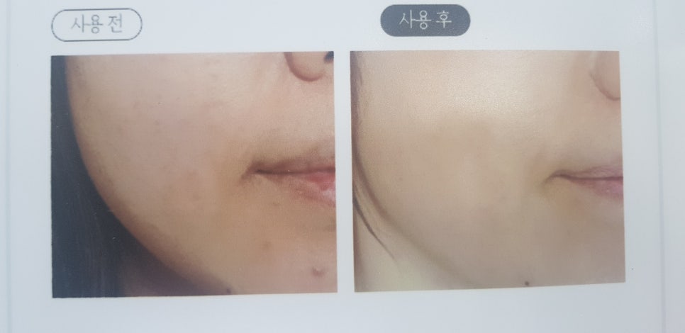피부살롱 이미지