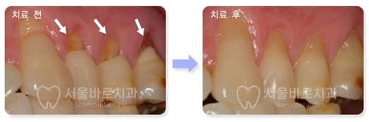 서울바로치과 이미지
