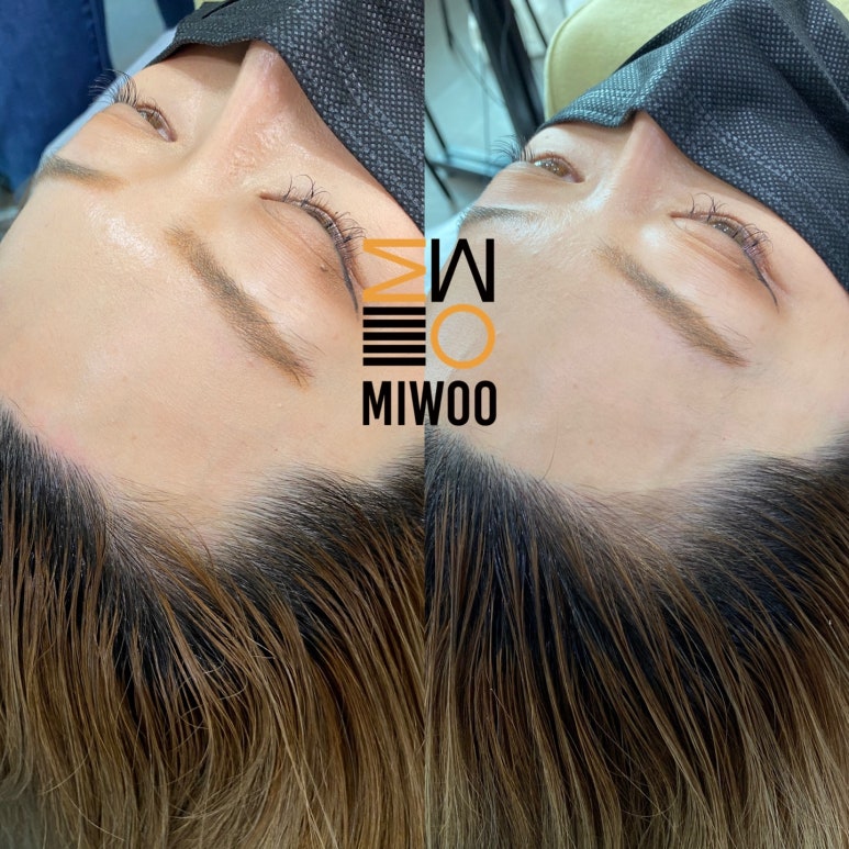 칼라헤어라인 이미지