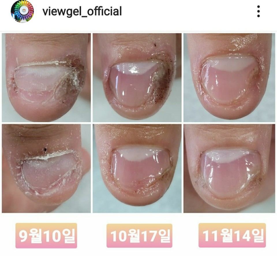 스타네일 이미지