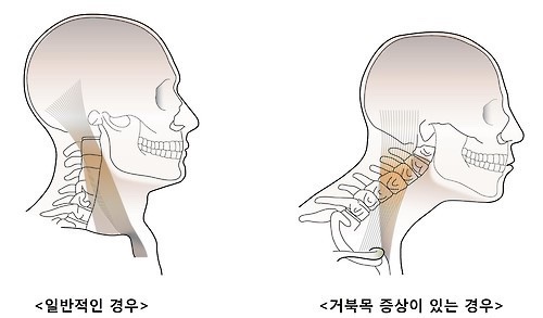 쎄짐 이미지