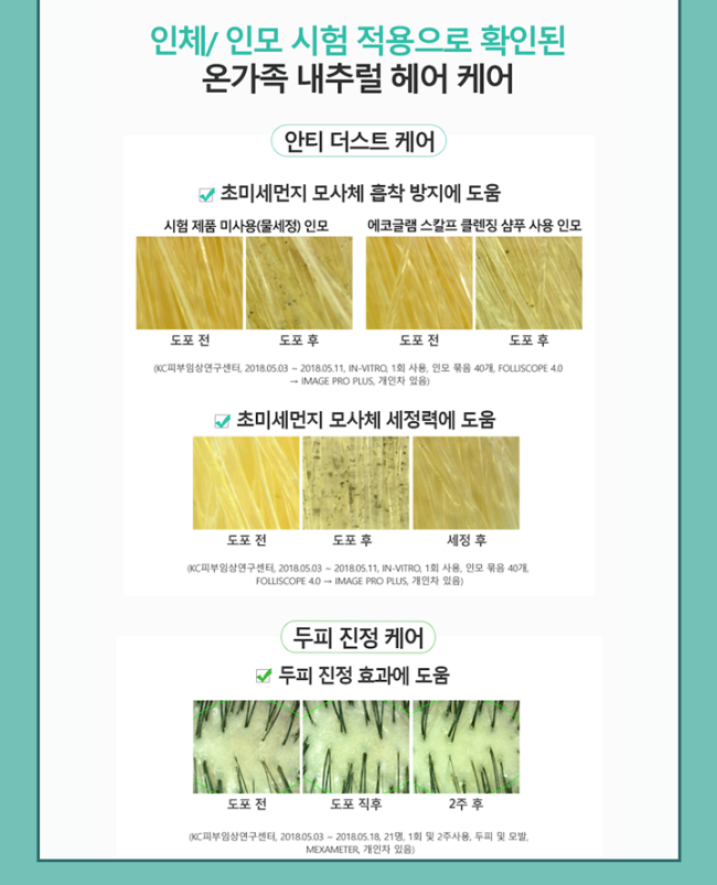 온스칼프 이미지