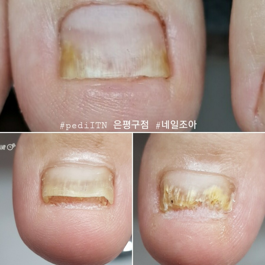 네일조아 이미지