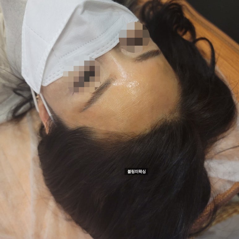 미로헤어라인 이미지