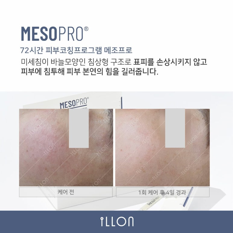 피부관리콜 이미지