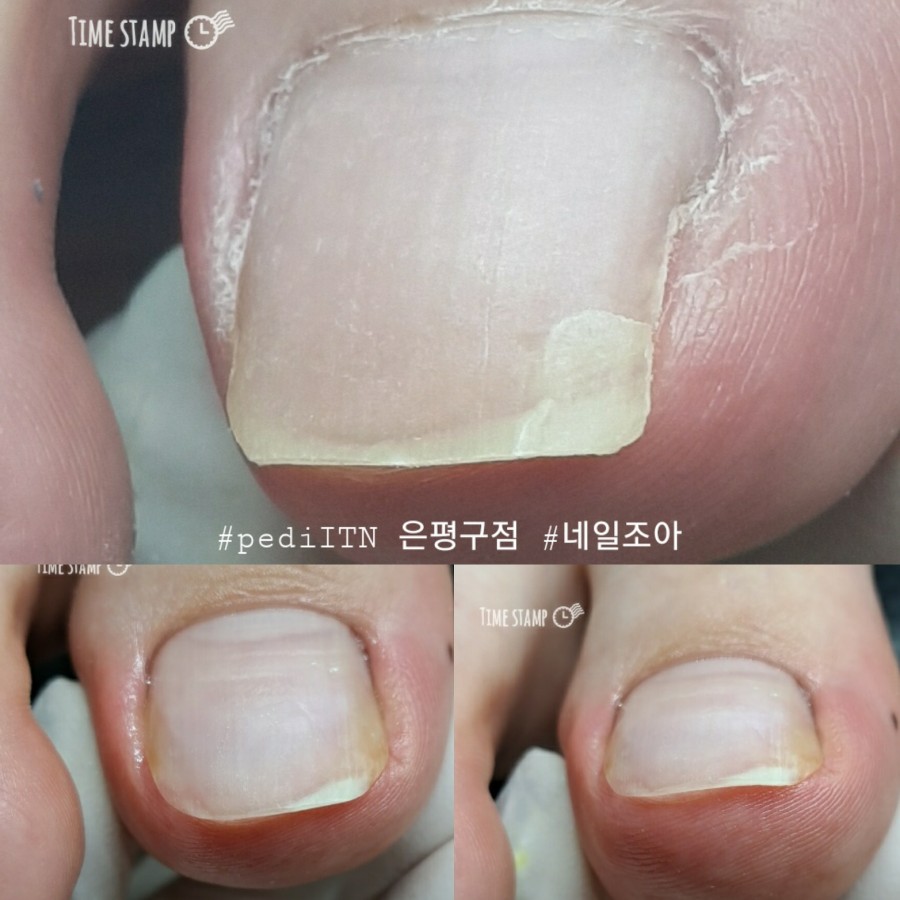 네일조아 이미지
