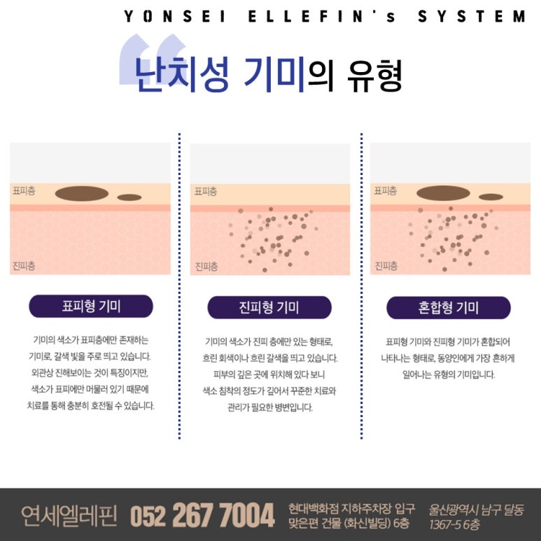 연세엘레핀의원 이미지