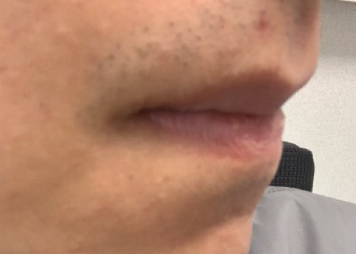 청담엔케이피부과청담NK피부과 이미지