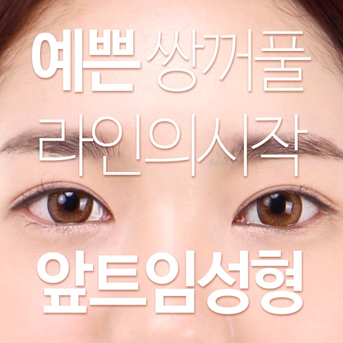 아름다운성형외과 이미지
