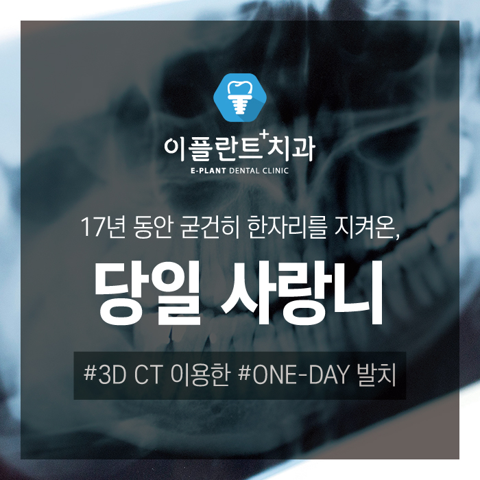 이플란트치과 이미지