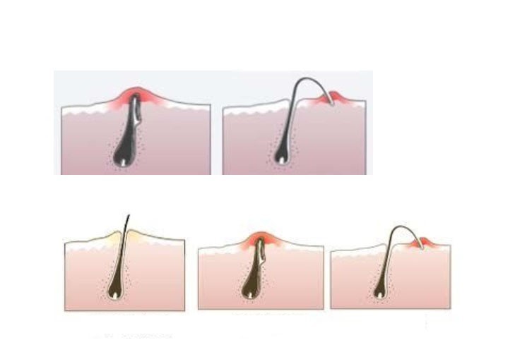 라파헤어 이미지
