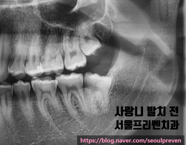 서울프리벤치과의원 이미지