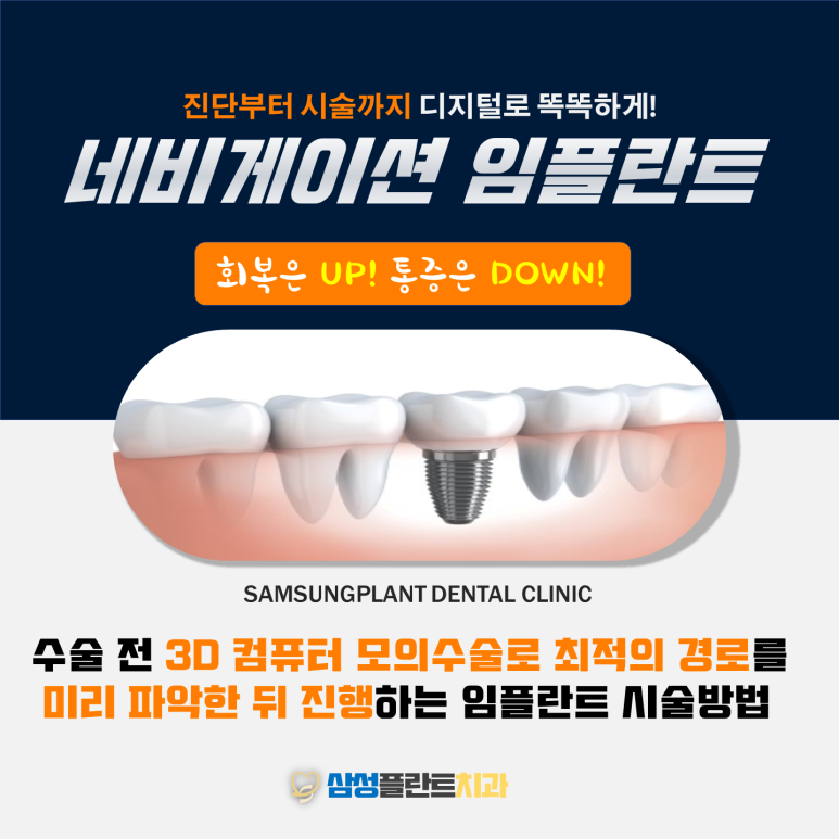삼성플란트치과 이미지