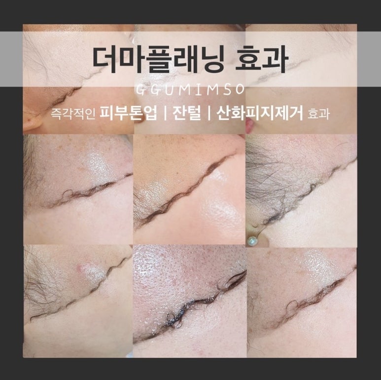 피부하는날 이미지