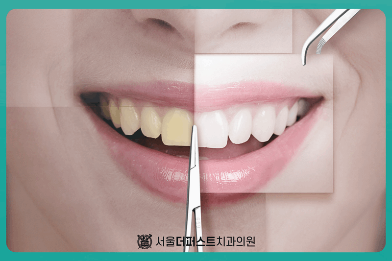 더퍼스트치과의원 이미지