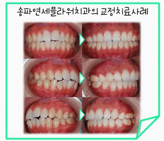 연세플라워치과의원 이미지
