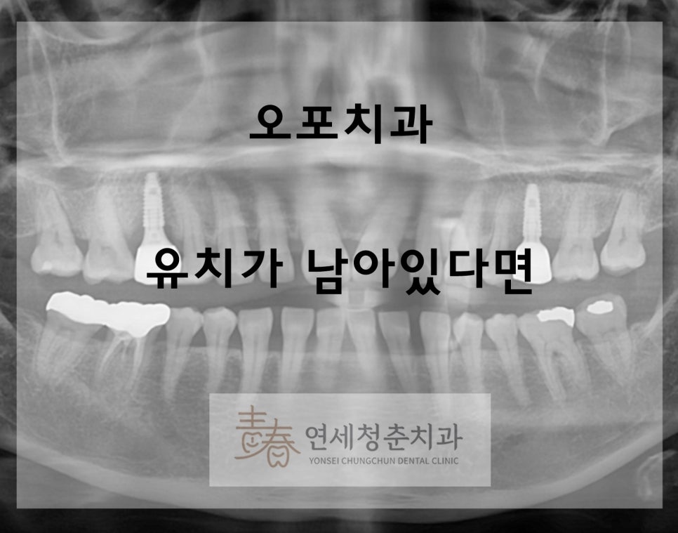오포연세치과 이미지